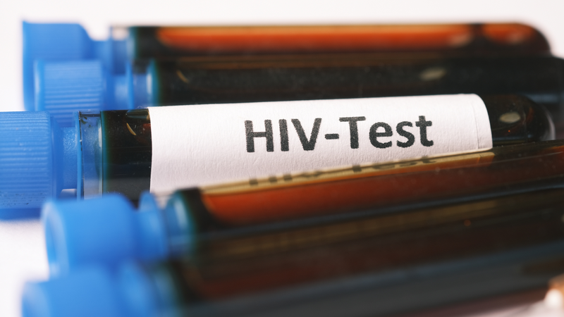 Xét nghiệm HIV có nhiều loại với độ chính xác khác nhau, phát hiện từ khoảng 10 - 90 ngày sau phơi nhiễm