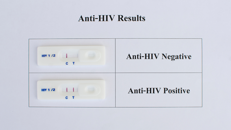 Xét nghiệm HIV 6 tháng âm tính thường chính xác, nhưng vẫn có thể bị ảnh hưởng bởi một số yếu tố hiếm gặp
