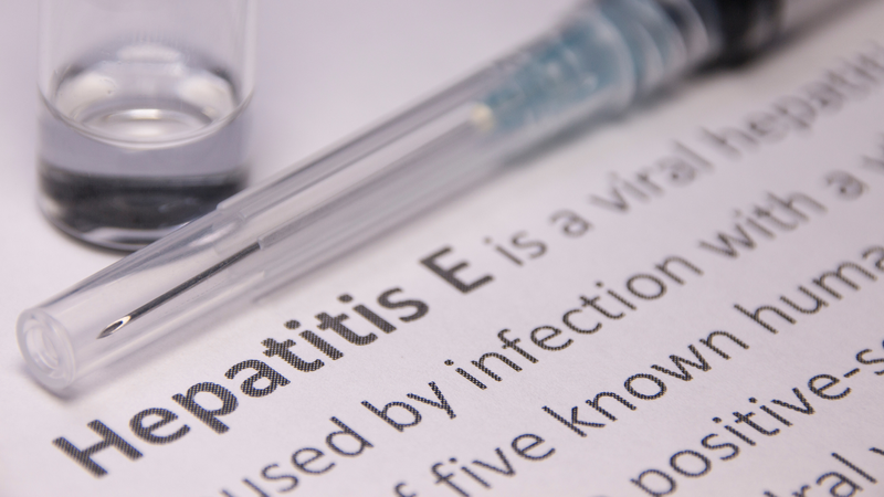 Viêm gan E là bệnh do virus HEV gây ra, ảnh hưởng đến chức năng gan