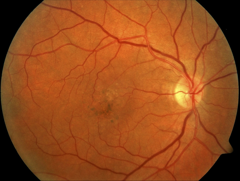 Ăn ốc bông có tác dụng gì? Ai không nên ăn ốc bông? 2