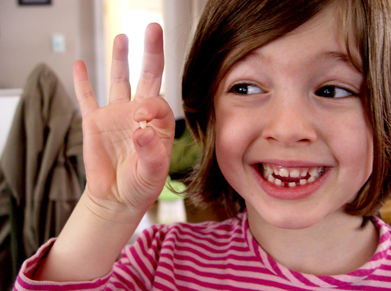 Bao nhiêu tuổi thì hết thay răng? Những điều cần lưu ý để răng vĩnh viễn mọc đều đẹp 2