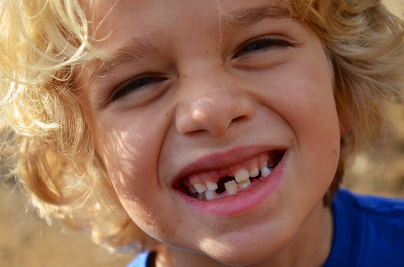 Bao nhiêu tuổi thì hết thay răng? Những điều cần lưu ý để răng vĩnh viễn mọc đều đẹp 1