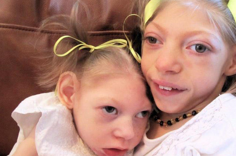 Bệnh Batten là gì? Nguyên nhân gây bệnh và cách điều trị thế nào? 1