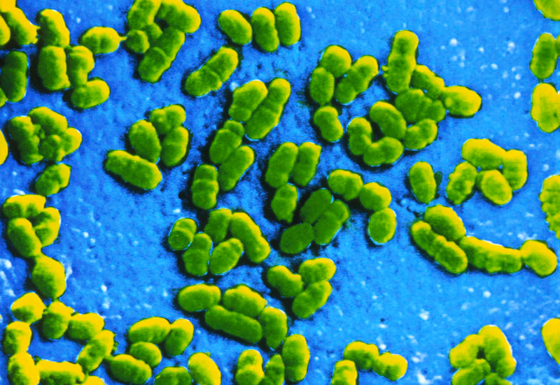 Bệnh Brucellosis: Những thông tin quan trọng cần biết 1