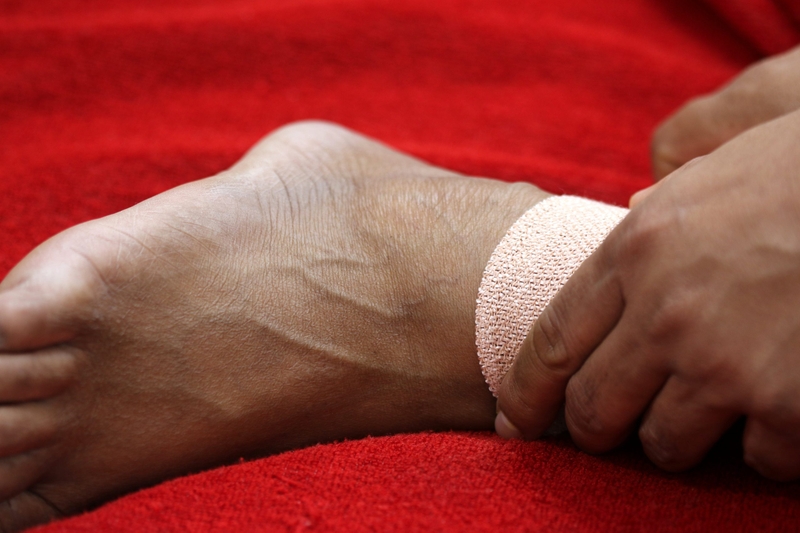 Bị cứng khớp cổ chân sau phẫu thuật do nguyên nhân gì? Các yếu tố nguy cơ bạn cần biết 1