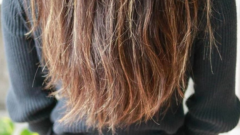 Bí quyết phục hồi nang tóc tự nhiên, an toàn và đơn giản 2