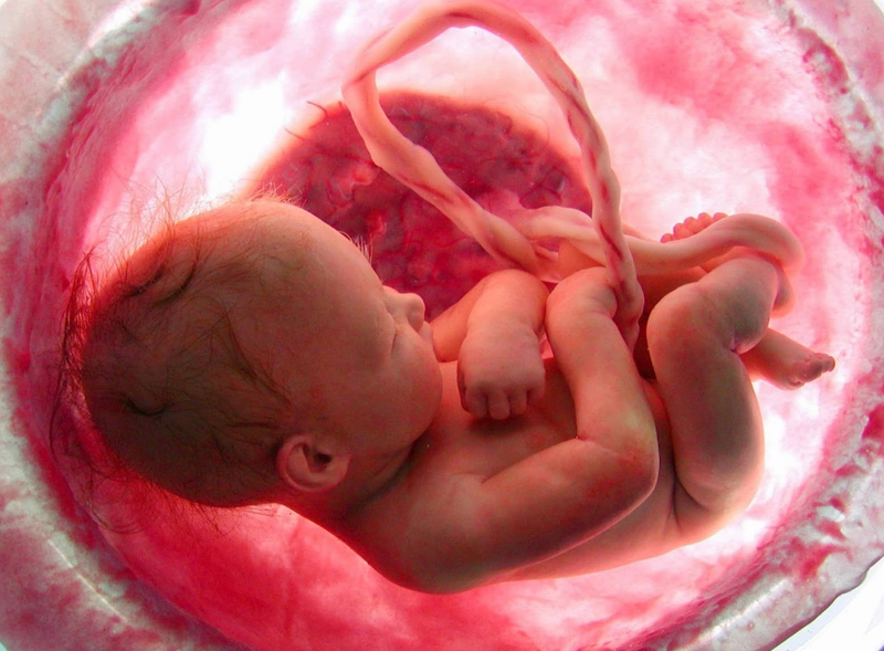 Các loại siêu âm thai đang được ứng dụng phổ biến hiện nay 3