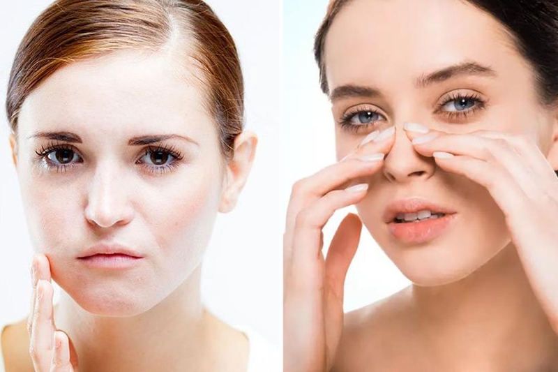 Căng da mặt truyền thống hiệu quả ra sao? Lão hóa da mức độ nào thì thực hiện? 3