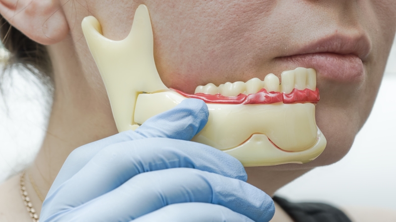 Chỉnh hàm hô móm ở đâu?