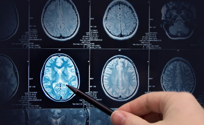 Chụp cắt lớp có hại không và khi nào thì gây nguy hiểm? 2