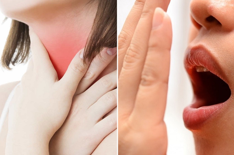 Có hạt nằm trong ngách của amidan là bị gì? Cách điều trị ra sao? 2