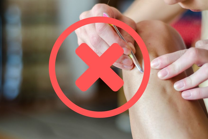 Công nghệ triệt lông New E-Light khác công nghệ Diode Laser thế nào? 4