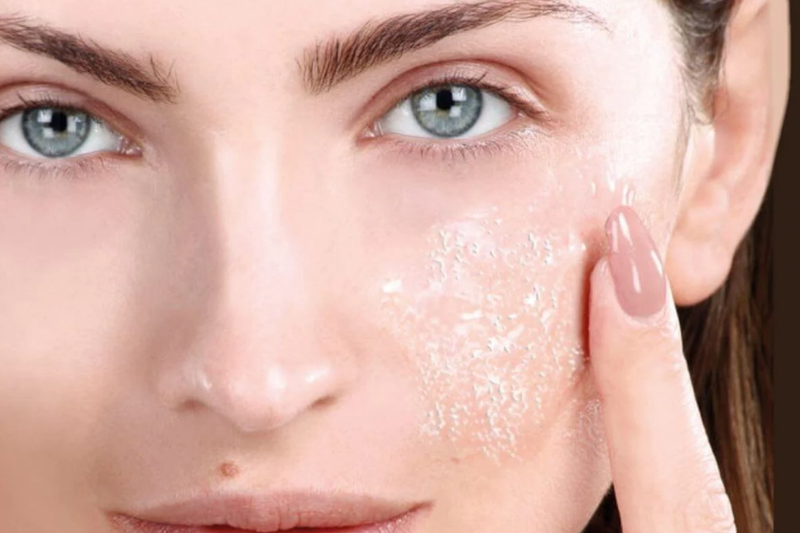 Da bị tăng sắc tố sau peel là hiện tượng gì? Có khắc phục được không? 2