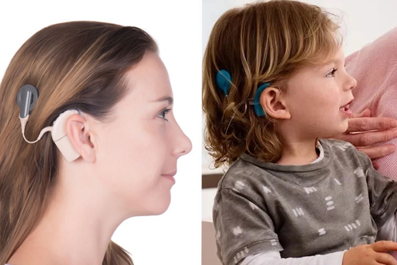 bai-viet/diec-than-kinh-la-gi-bi-diec-than-kinh-phai-lam-sao.html 3