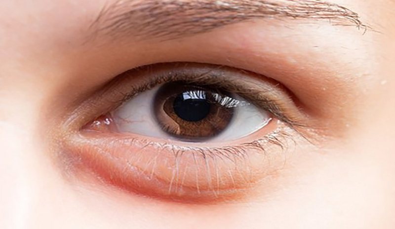 Điện di lạnh là gì? Điện di nóng là gì? Hướng dẫn cách chăm sóc da sau khi sử dụng điện di 3