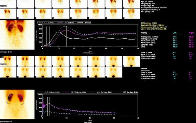 Đồng vị phóng xạ: Ứng dụng trong chẩn đoán và điều trị khối u 1