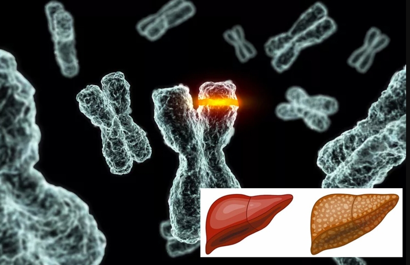 Gan nhiễm mỡ sau sinh có nguy hiểm không? Nguyên nhân và cách điều trị 2