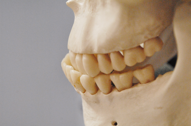 Nhai 1 bên bị lệch mặt làm sao khắc phục? 4