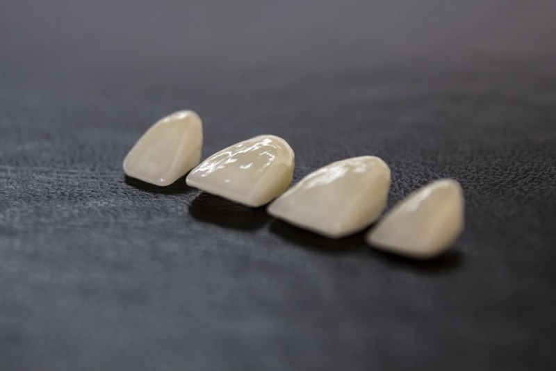 Giá răng sứ zirconia có cao không? Ưu, nhược điểm của răng sứ zirconia  1