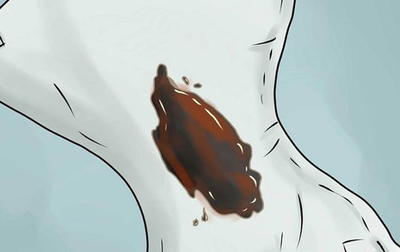 Giải đáp thắc mắc: Hết kinh 10 ngày lại ra máu nâu là bệnh gì? 1