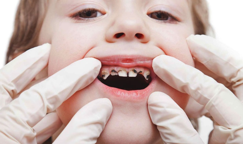 Giải đáp: Tuổi nào nên cho bé uống nước ép trái cây? 4