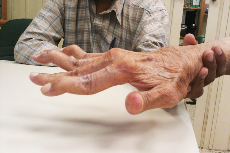 Hiểu cơ chế viêm khớp dạng thấp để kiểm soát bệnh hiệu quả 5