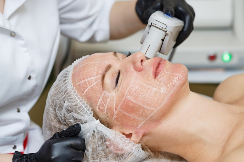 Hifu và Thermage: Phương pháp nâng cơ, trẻ hóa da nào tốt? 1