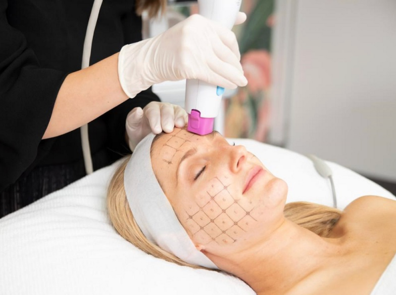 Hifu và Thermage: Phương pháp nâng cơ, trẻ hóa da nào tốt? 2