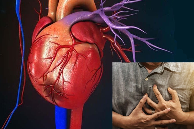 Hoại tử cơ tim do nhồi máu cơ tim là gì? Ứng dụng công nghệ tế bào gốc trong điều trị 1