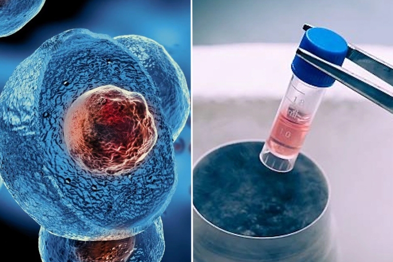 Hoại tử cơ tim do nhồi máu cơ tim là gì? Ứng dụng công nghệ tế bào gốc trong điều trị 3