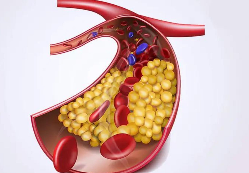 Hội chứng đường hầm cổ chân và những điều cần biết 3
