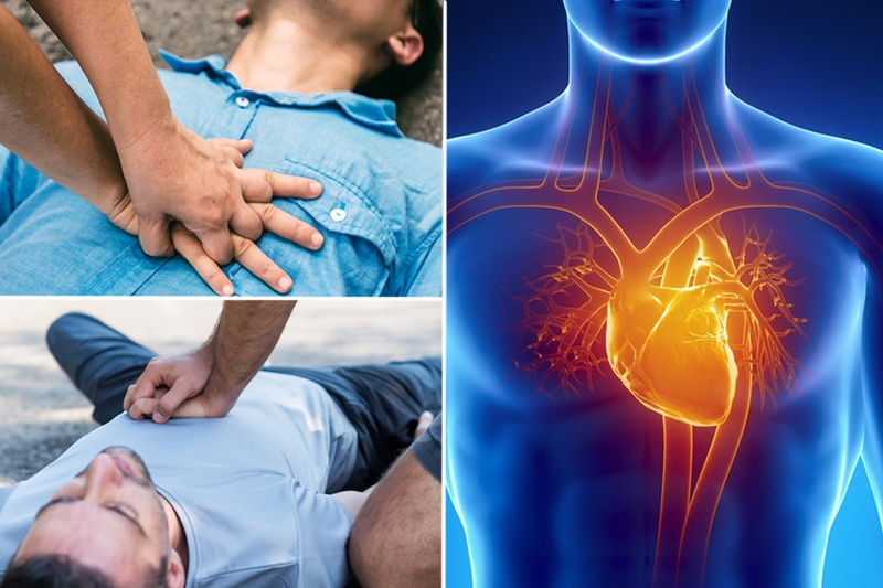 Hướng dẫn cấp cứu nhồi máu cơ tim và những điều cần lưu ý 1