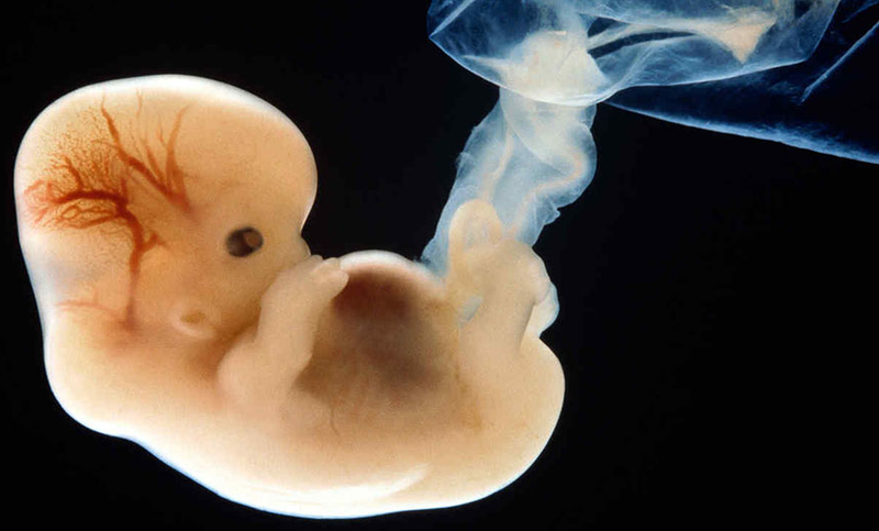 Làm thế nào mẹ nhận biết dấu hiệu thai 5 tuần phát triển bình thường? 1