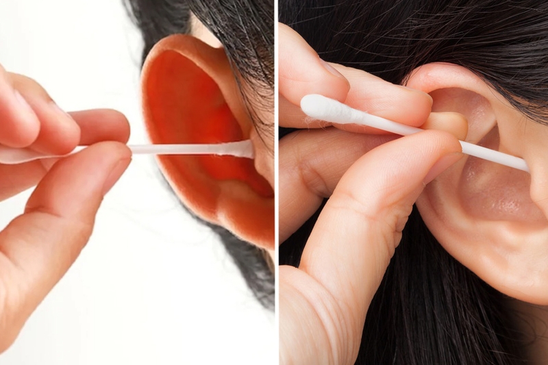 Lấy ráy tai nội soi có an toàn không? Những điều cần lưu ý sau khi lấy ráy tai nội soi 2