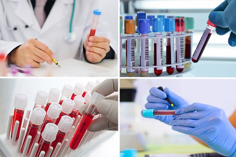 Miễn dịch tập nhiễm là gì? Vai trò của miễn dịch tập nhiễm trong bảo vệ sức khỏe 5