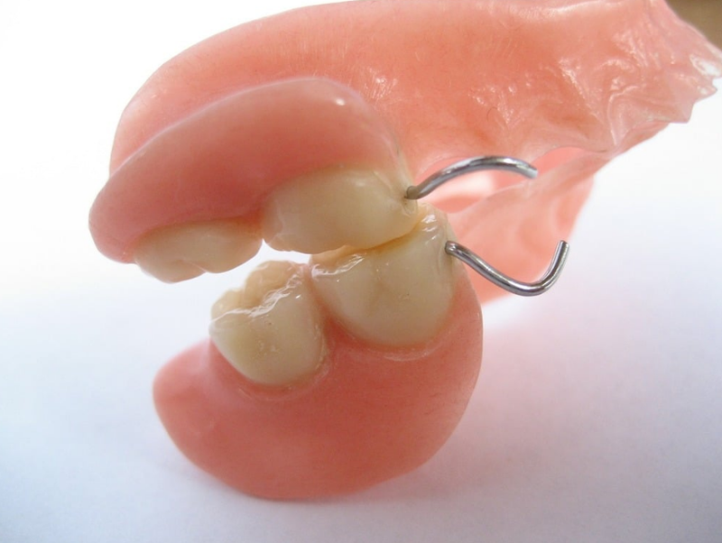 Người 60 tuổi có nên trồng răng không? Phương pháp trồng răng nào an toàn, hiệu quả? 2