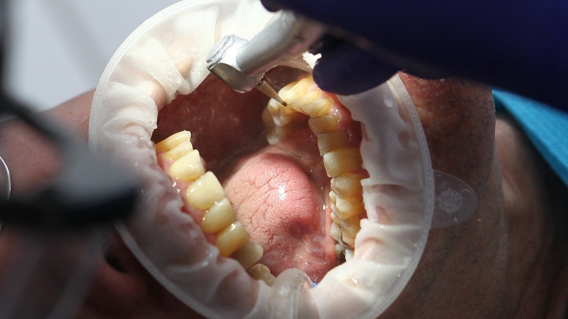 Người 60 tuổi có nên trồng răng không? Phương pháp trồng răng nào an toàn, hiệu quả? 5