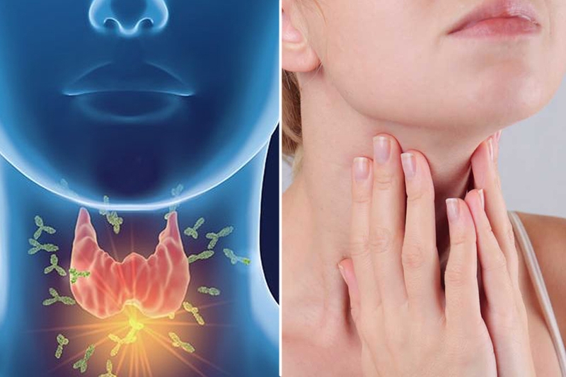 Người bị tuyến giáp có ăn được mật ong không? Những thực phẩm tốt cho bệnh nhân tuyến giáp 2