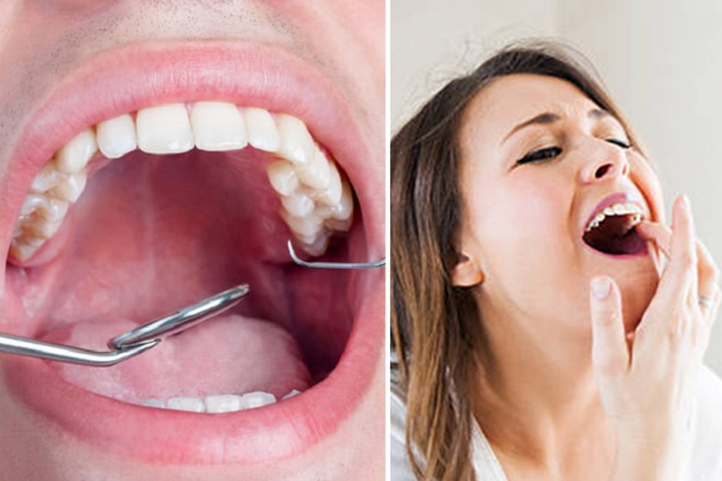 Nguyên nhân bị ê răng hàm trên và cách xử lý 1