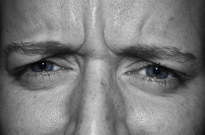 Nguyên nhân gây cận thị là gì? Khi nào cần đi khám? 2