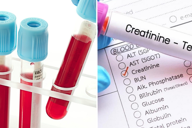 Nguyên nhân, triệu chứng và cách điều trị u túi mật lành tính 3