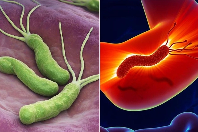 Nguyên nhân viêm dạ dày mạn tính ở trẻ em? Biện pháp điều trị và phòng ngừa 1