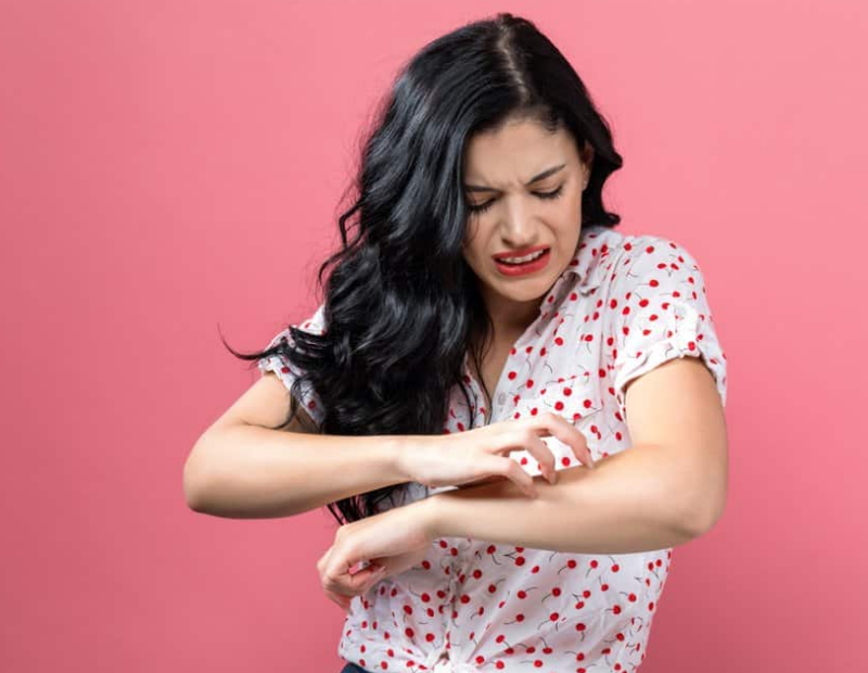 Nhận biết các dấu hiệu bị ghẻ và cách điều trị hiệu quả? 4