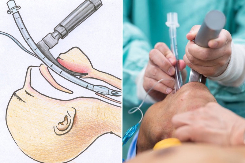 Nhận diện sốc tim trong nhồi máu cơ tim để xử lý kịp thời, hiệu quả 3