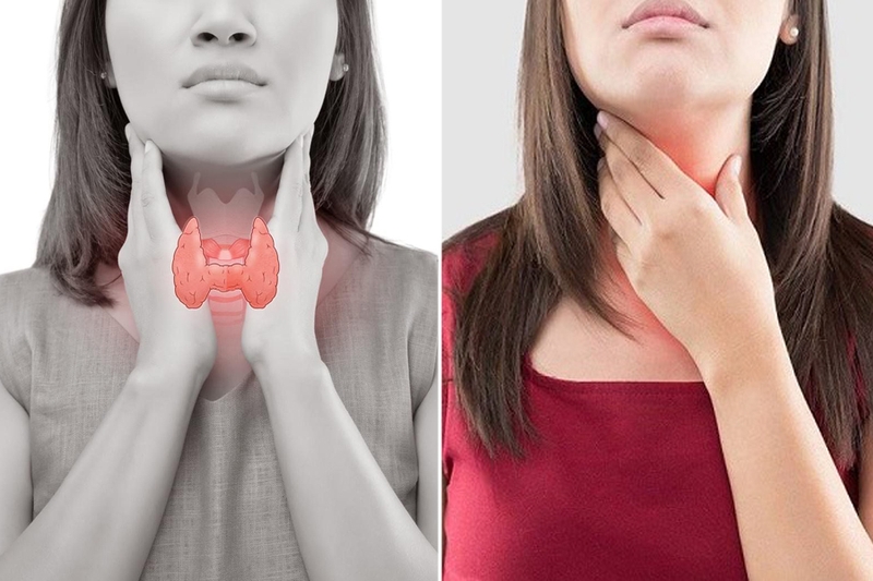 Nhân thùy phải tuyến giáp TIRADS 3 là bệnh gì? Các phương pháp điều trị hiệu quả 1