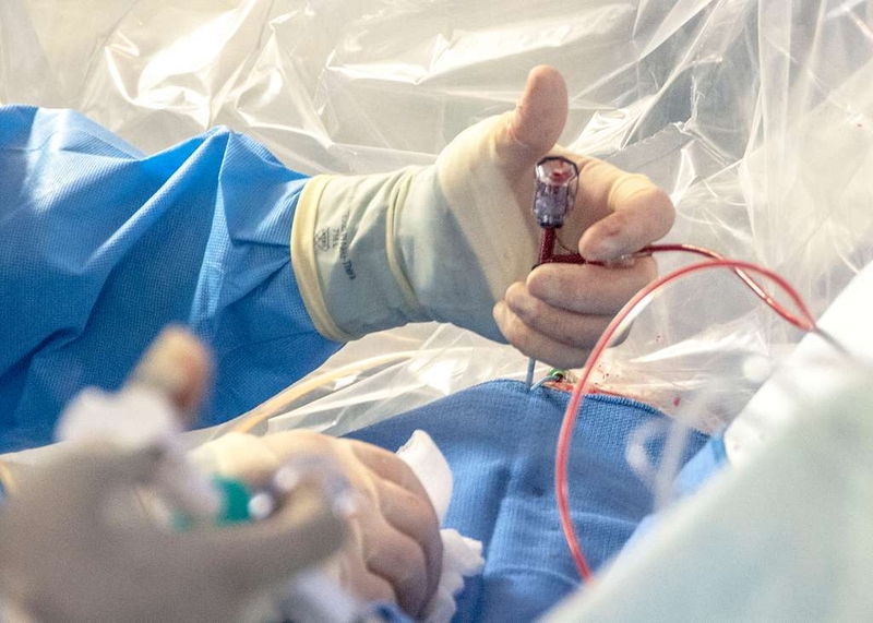 Nhồi máu cơ tim tương đương ST chênh lên là gì? Các dạng cần biết và cách chẩn đoán phân biệt 2