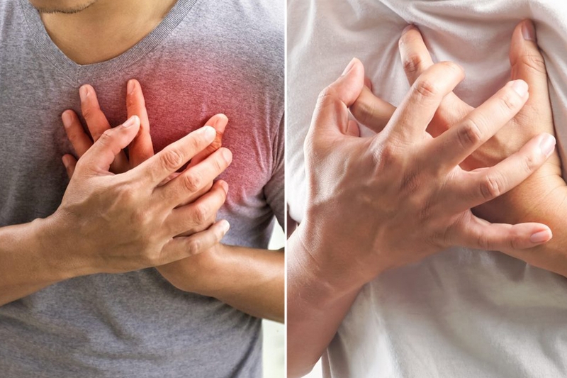 Nhồi máu cơ tim tương đương ST chênh lên là gì? Các dạng cần biết và cách chẩn đoán phân biệt 3