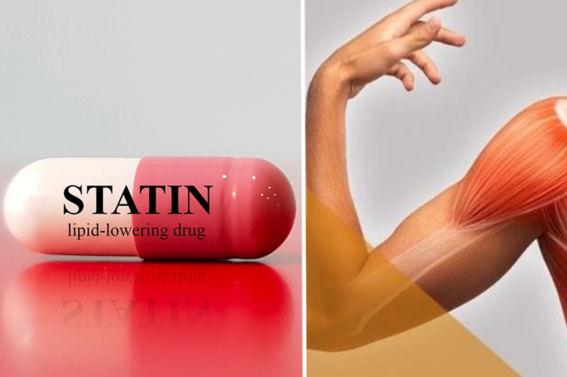 Những điều cần biết về bệnh viêm cơ hoại tử qua trung gian miễn dịch 3