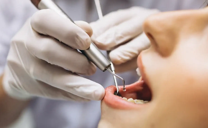 Những lưu ý khi niềng răng ai cũng cần biết 5