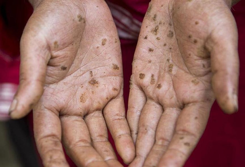 Nước giếng khoan có sạch không? Có dùng để uống được không? 3